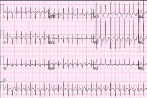 7C8016AB-7560-4C08-ADBE-5F758427EC1F
